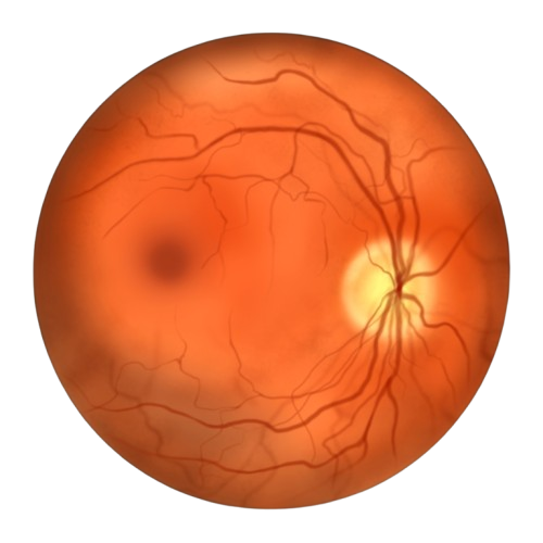 Retina